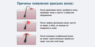 Иллюстрация 1 Иллюстрация 1