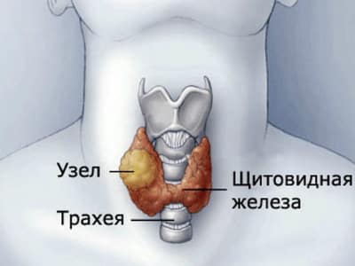 Иллюстрация 3