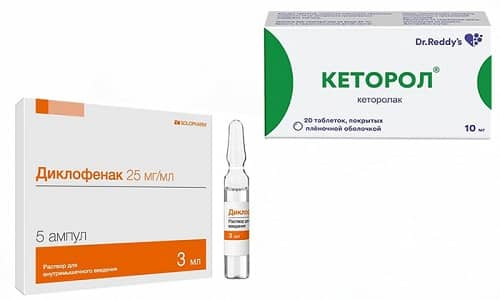 Для снятия болей сегодня часто назначают Кеторол или Диклофенак