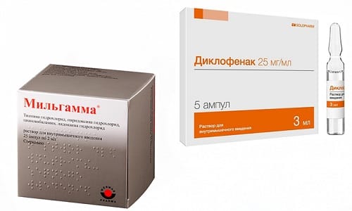 Боль при поражении головного мозга устраняют препараты Диклофенак и Мильгамма