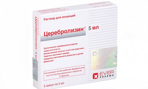 Церебролизин хорошо помогает при нарушении памяти