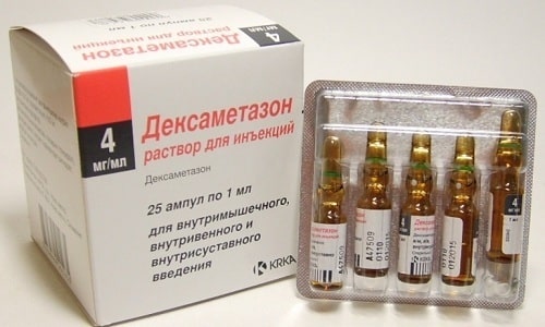 Для постановки инъекции смешивают 1 мл Дексаметазона и 3 мл Диклофенака