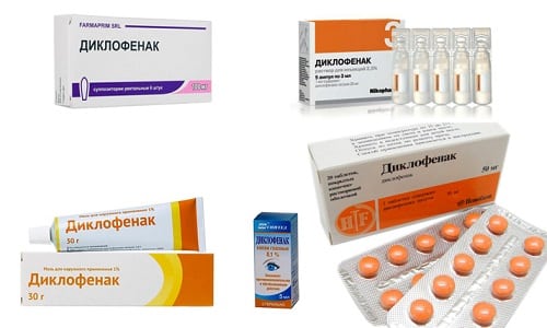 Диклофенак в любых формах рекомендуется использовать для устранения болевых ощущений умеренной интенсивности