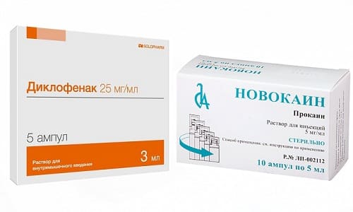 Лечение заболеваний опорно-двигательного аппарата выполняют с помощью Новокаина и Диклофенака
